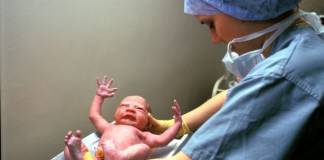 Cesarean Born Baby