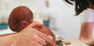 Lumbar Puncture in Premature Babies