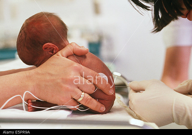 Lumbar Puncture in Premature Babies – Definition, Benefits and Complications