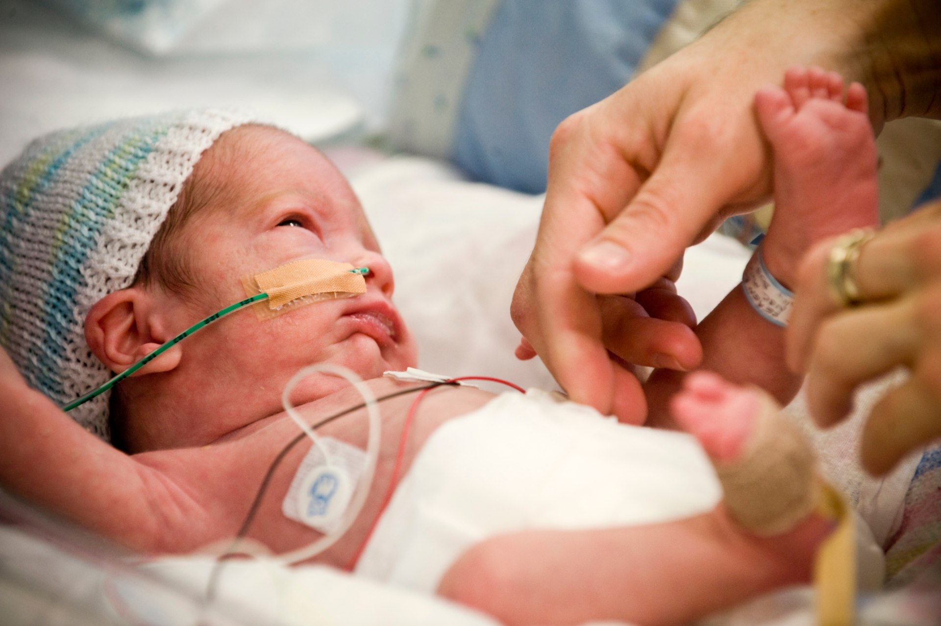 Premature Babies : Facts and Trivia