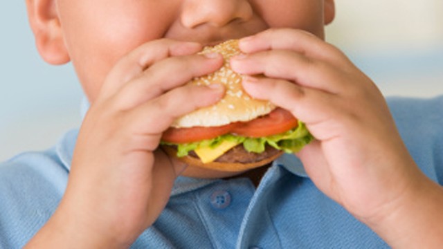 Childhood Obesity – Issues and How to Control