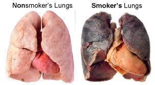 Why Do We Need to Make Distinctions Between Smoker’s and Non-smoker’s Lung Cancer?