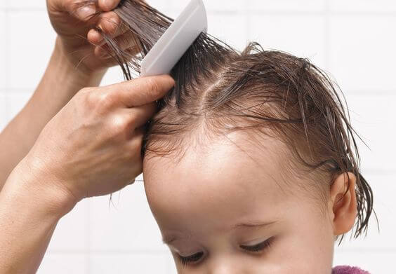For Parents: Useful Tips on How to Easily Find Head Lice